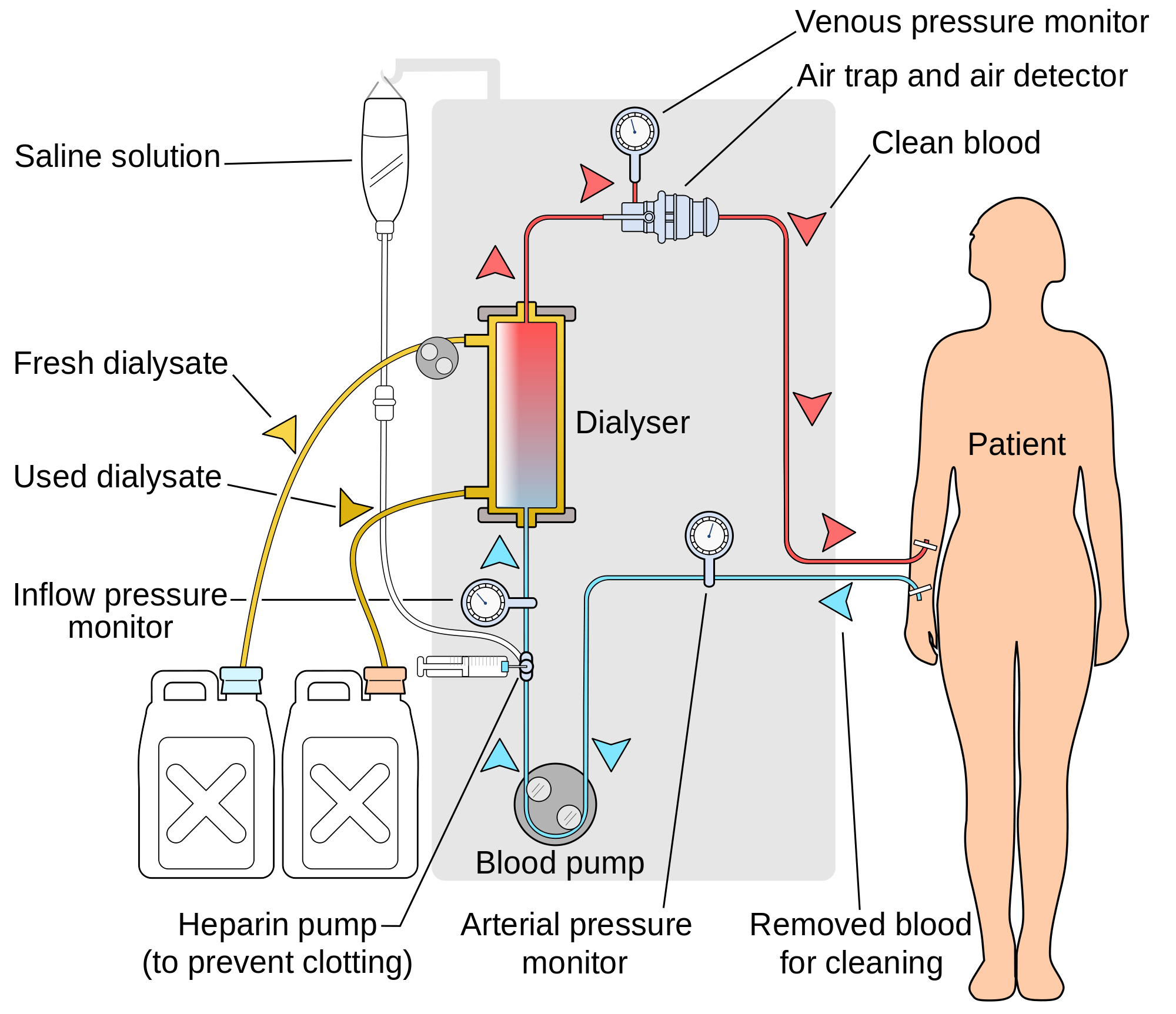 How Effective Is Kidney Dialysis